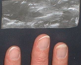 Fingernagel Fingerngel beim Gitarre spielen